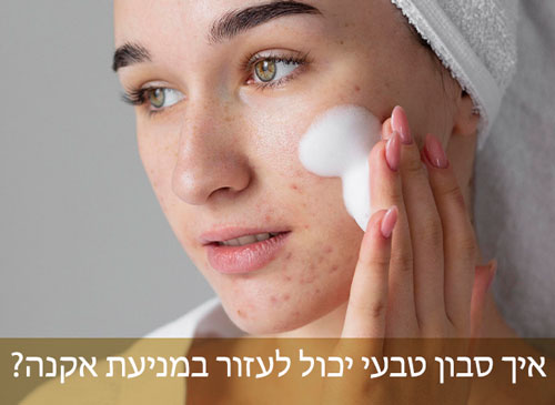 איך סבון טבעי יכול לעזור במניעת אקנה ולמה? בדף זה תגלו